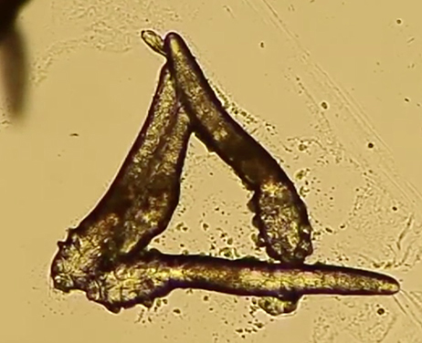 まつ毛ダニ（デモデックス）