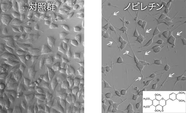 ノビレチンによる神経細胞の活性化の様子を示す顕微鏡写真