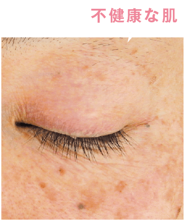 顔中に、小じわが大発生 する危険性もある?!