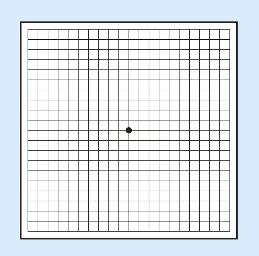 自覚症状があったらスグに眼科へ！