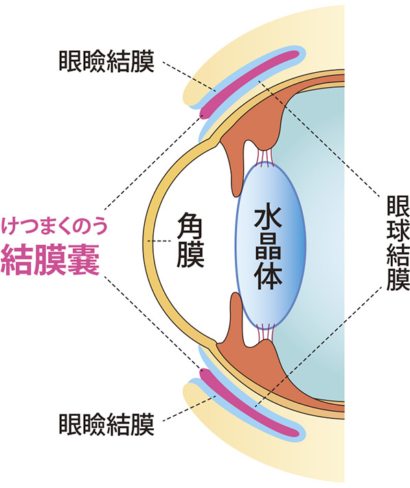 レンズがどこに行ったか分からないときの対処法
